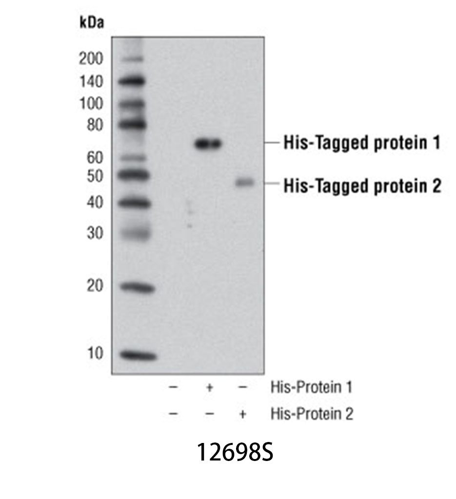 His-Tag (D3I1O) XP Rabbit mAb