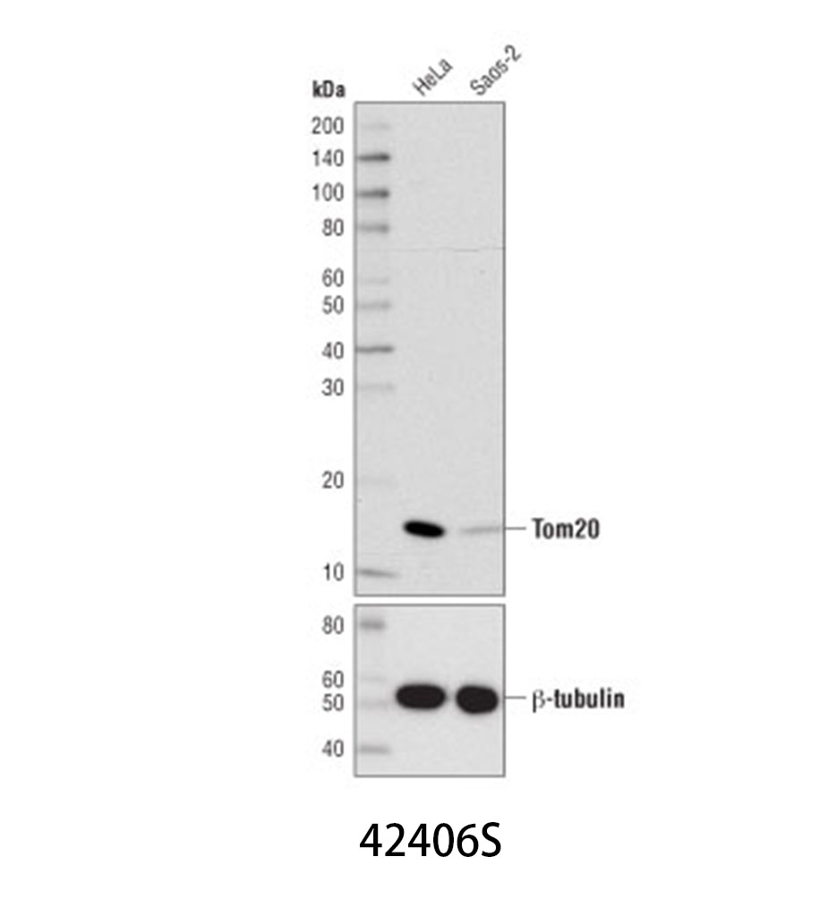 Tom20 (D8T4N) Rabbit mAb