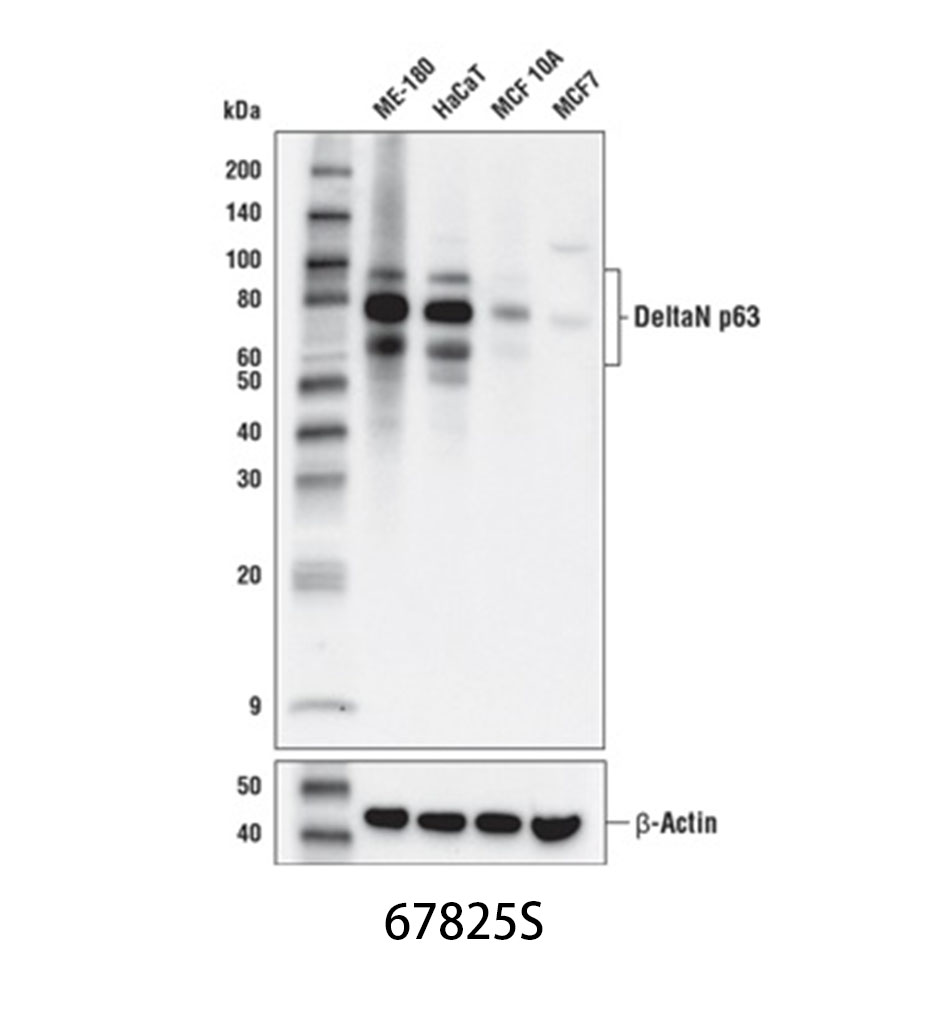 DeltaN p63 (E6Q3O) Rabbit mAb