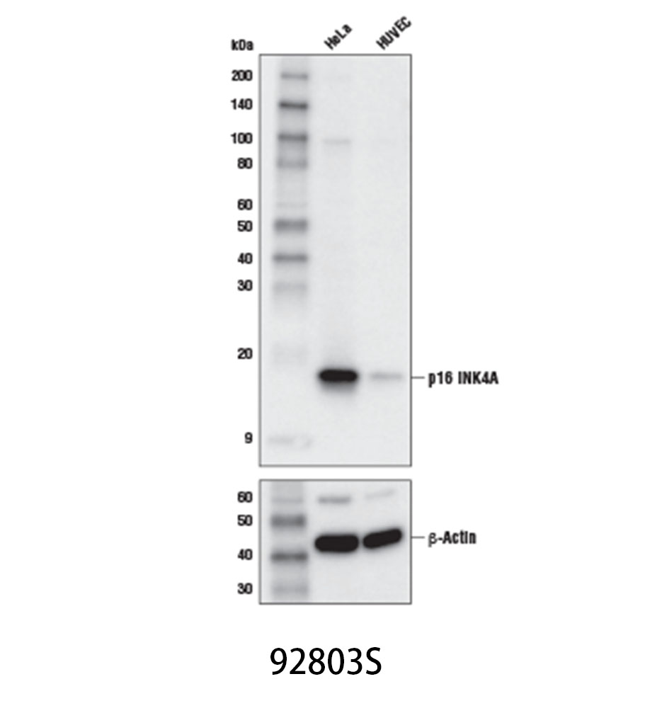 p16 INK4A (D3W8G) Rabbit mAb