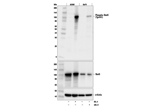 Phospho-Stat6 (Tyr641) (D8S9Y) Rabbit mAb