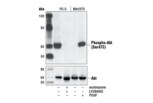 Phospho-Akt (Ser473) (D9E) XP Rabbit mAb