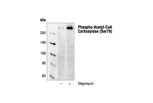 Phospho-Acetyl-CoA Carboxylase (Ser79) Antibody