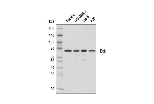 Btk (D3H5) Rabbit mAb