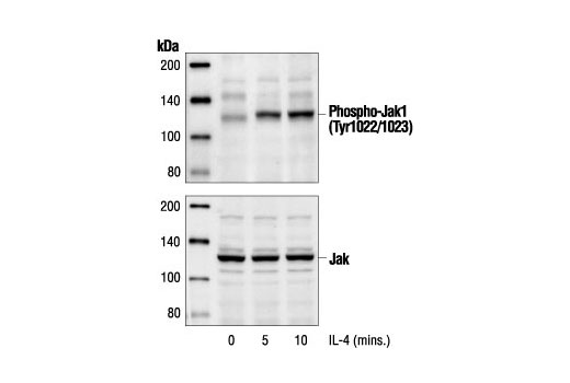 Phospho-Jak1 (Tyr1034/1035) Antibody