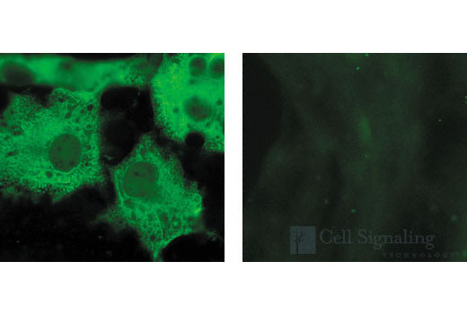 GST (26H1) Mouse mAb
