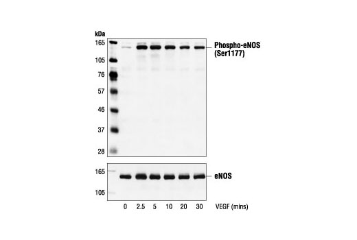 Phospho-eNOS (Ser1177) Antibody