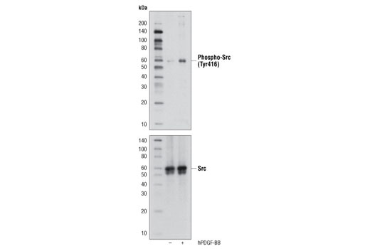 Phospho-Src Family (Tyr416) (D49G4) Rabbit mAb