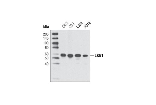 LKB1 (D60C5) Rabbit mAb