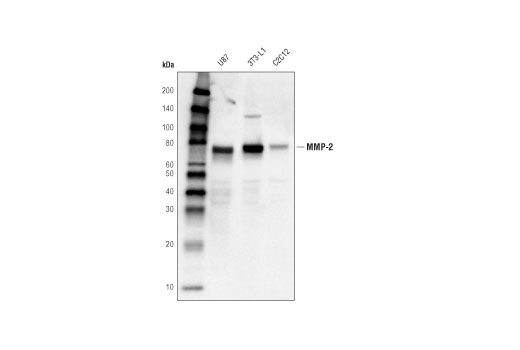 MMP-2 (D2O4T) Rabbit mAb