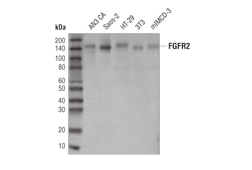 FGF Receptor 2 (D4L2V) Rabbit mAb