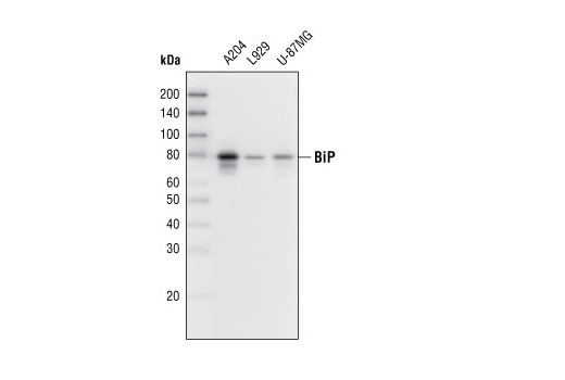 ER Stress-induced Autophagy Antibody Sampler Kit
