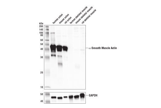 α-Smooth Muscle Actin (1A4) Mouse mAb (IF Formulated)