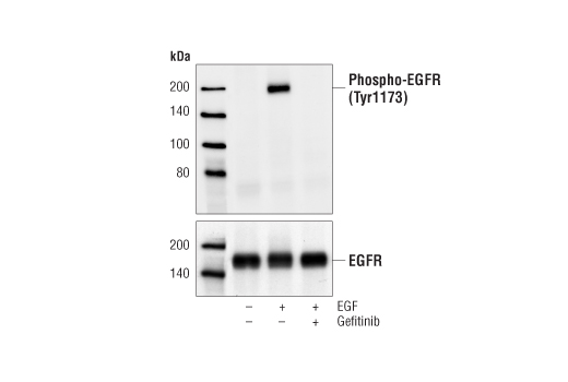 Phospho-EGF Receptor (Tyr1173) (53A5) Rabbit mAb