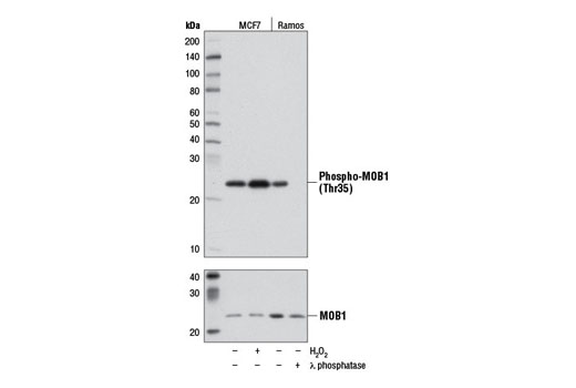 Phospho-MOB1 (Thr35) (D2F10) Rabbit mAb
