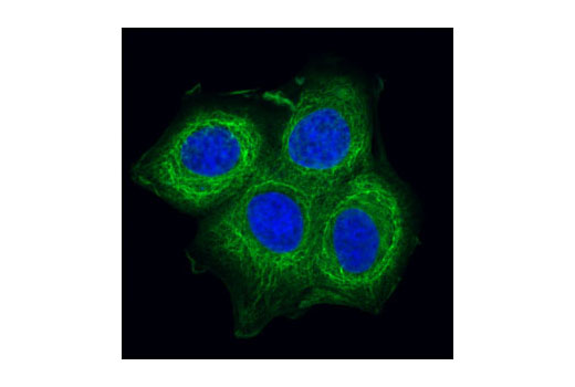 Pan-Keratin (C11) Mouse mAb (Alexa Fluor 488 Conjugate)