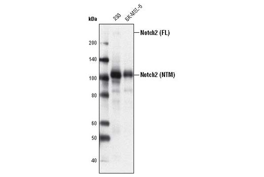 Notch2 (D76A6) XP Rabbit mAb