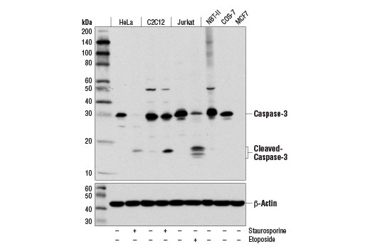 Apoptosis/Necroptosis Antibody Sampler Kit