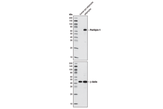 Perilipin-1 (D1D8) XP Rabbit mAb
