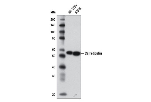 Calreticulin (D3E6) XP Rabbit mAb