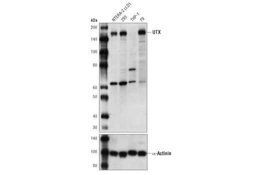 UTX (D3Q1I) Rabbit mAb