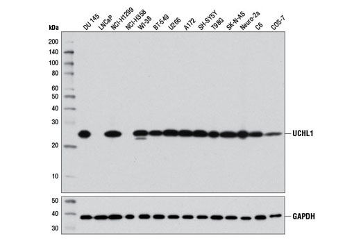 UCHL1 (D3T2E) XP Rabbit mAb