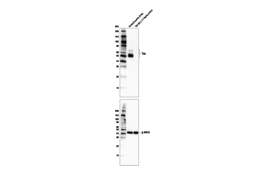 Tau (Tau46) Mouse mAb