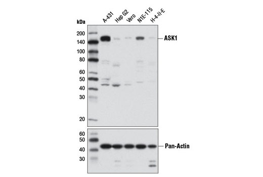 ASK1 (D11C9) Rabbit mAb