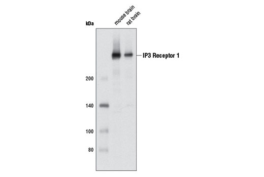IP3 Receptor 1 (D53A5) Rabbit mAb
