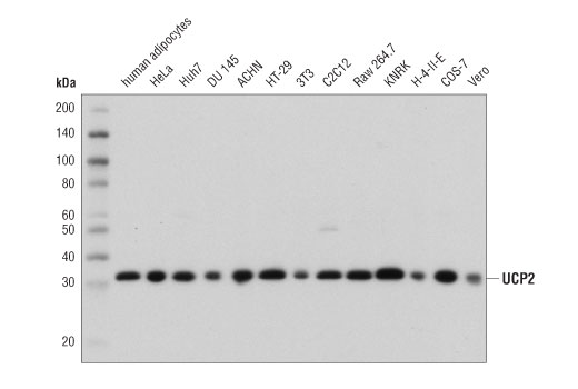 UCP2 (D1O5V) Rabbit mAb