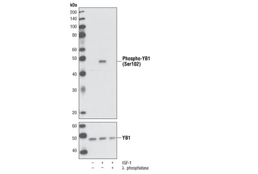 Phospho-YB1 (Ser102) (C34A2) Rabbit mAb