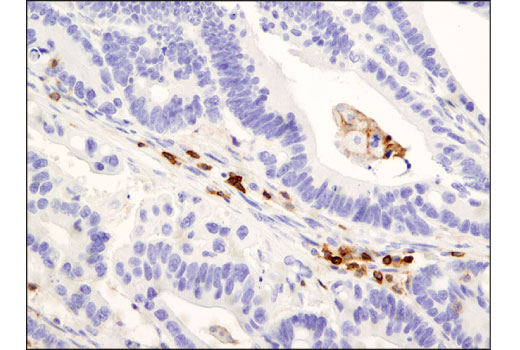 CD45RO (UCHL1) Mouse mAb (IHC Specific)