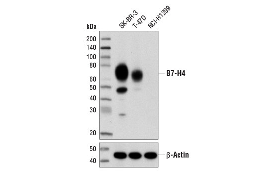 B7-H4 (D1M8I) XP Rabbit mAb