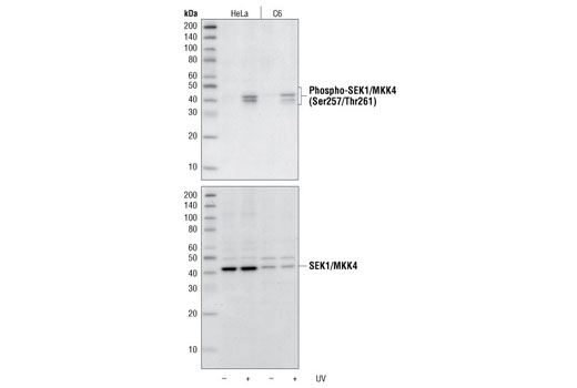 Phospho-SEK1/MKK4 (Ser257/Thr261) Antibody