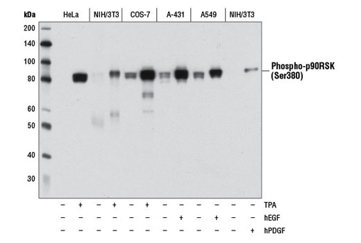 Phospho-p90RSK (Ser380) (D3H11) Rabbit mAb