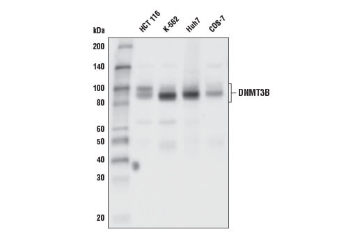 DNMT3B (E8A8A) XPRabbit mAb