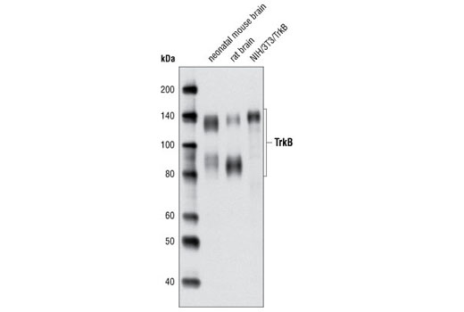 TrkB (80E3) Rabbit mAb