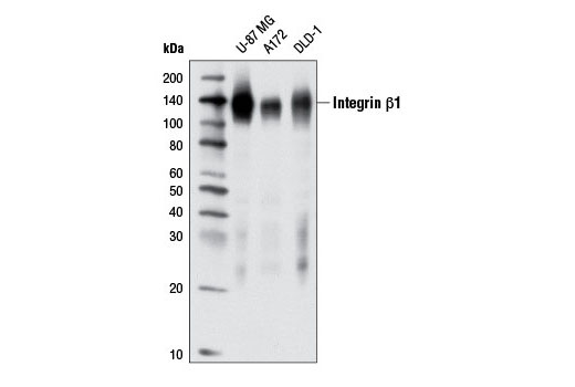 Integrin β1 (D2E5) Rabbit mAb