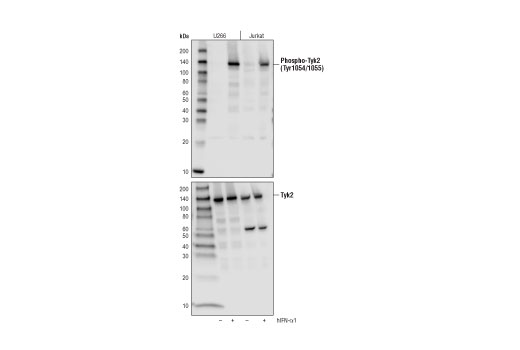 Phospho-Tyk2 (Tyr1054/1055) (D7T8A) Rabbit mAb