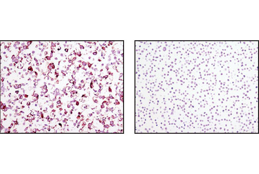 TRA-1-81 (TRA-1-81) Mouse mAb