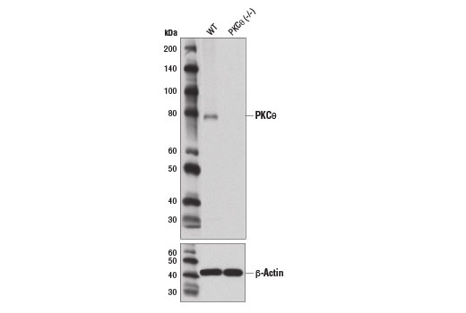 PKCθ (E1I7Y) Rabbit mAb