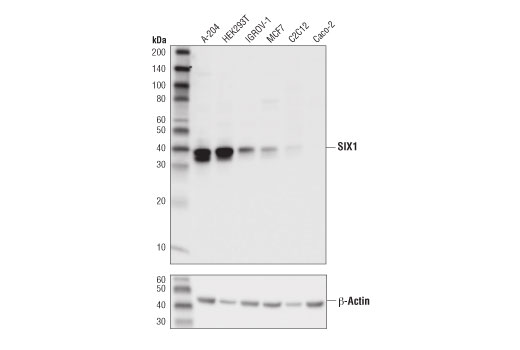 SIX1 (D5S2S) Rabbit mAb