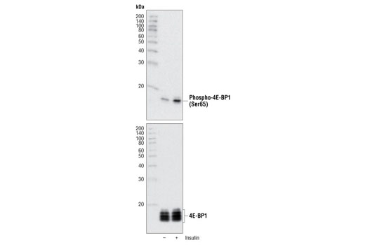 Phospho-4E-BP1 (Ser65) Antibody