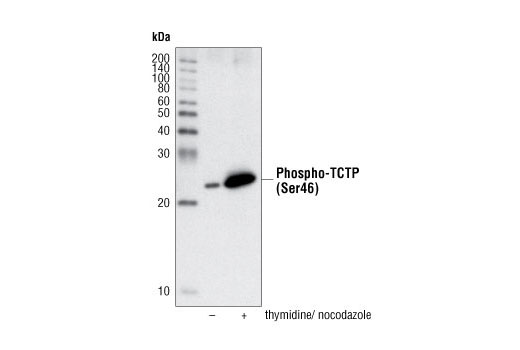 Phospho-TCTP (Ser46) Antibody