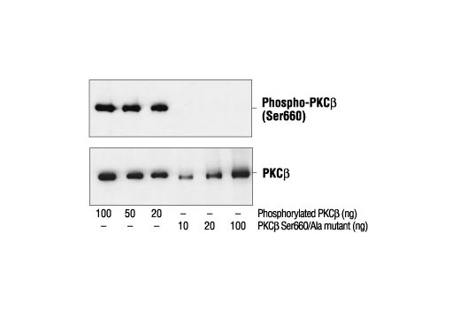 Phospho-PKC (pan) (βII Ser660) Antibody