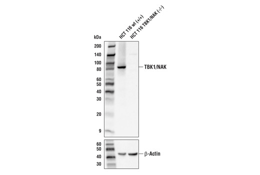 TBK1/NAK (E8I3G) Rabbit mAb