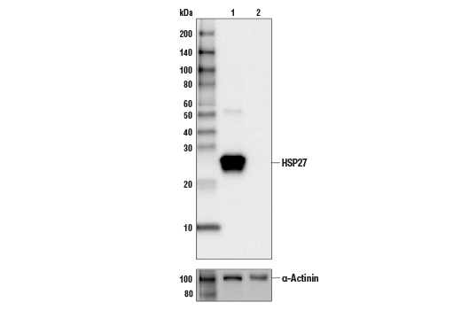 HSP27 (D6W5V) Rabbit mAb