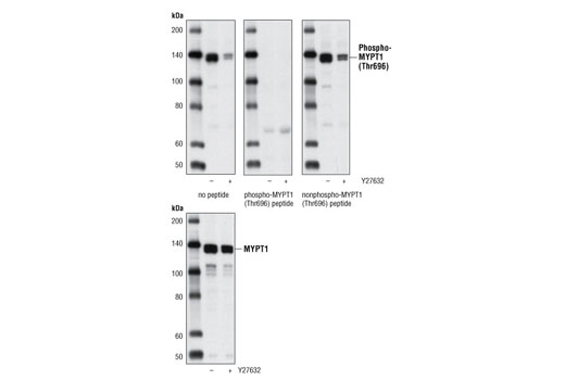 Phospho-MYPT1 (Thr696) Antibody