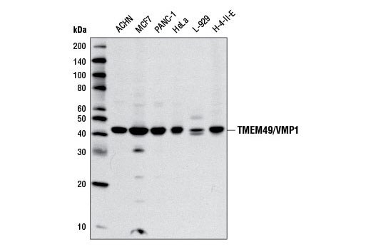 TMEM49/VMP1 (D1Y3E) Rabbit mAb