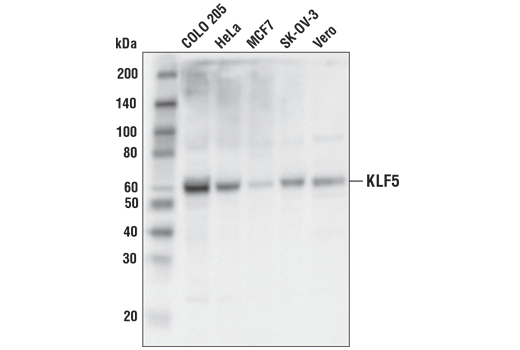 KLF5 (D7S3F) Rabbit mAb